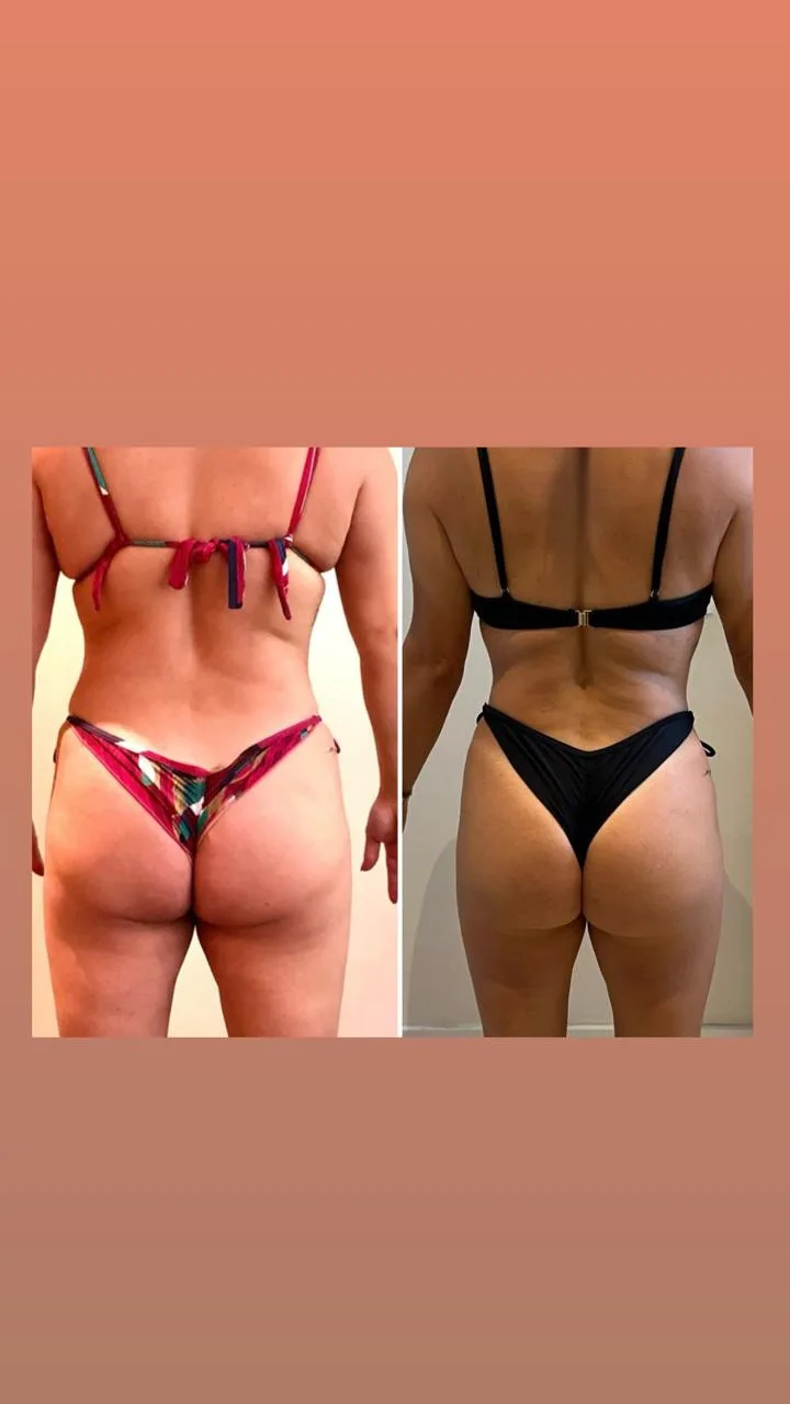 Transformação com método Kaizen - personal trainer São Paulo